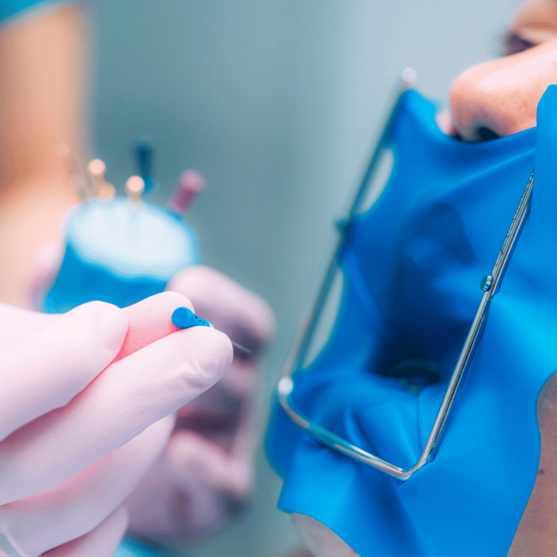 qué es la endodoncia en odontología