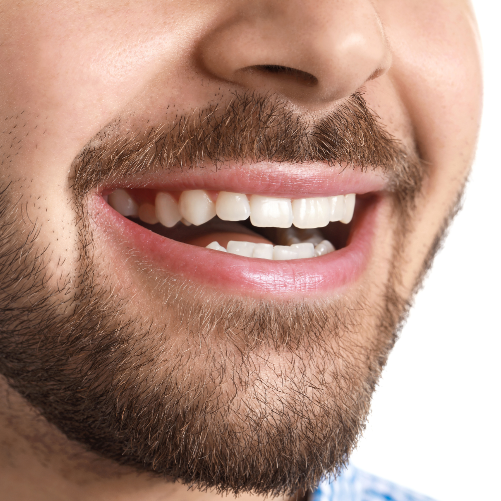 Diseño de Sonrisa Barranquilla