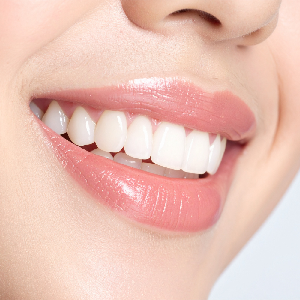 Cómo mejorar tu sonrisa en Barranquilla